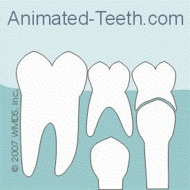 نظافة الاسنان اللبنية Cleaner teeth 3.gif?w=604